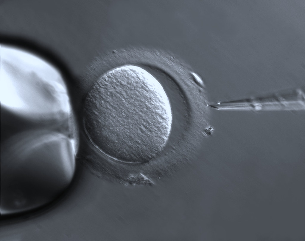 IVF Process: Step-by-Step Guide to Understanding In Vitro Fertilization